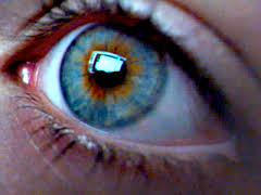 أسباب تغير لون إحدى العينين أسباب تغير لون إحدى العينين