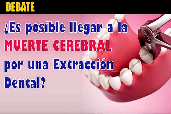 DEBATE: ¿Es posible llegar a la MUERTE CEREBRAL por una extracción dental?