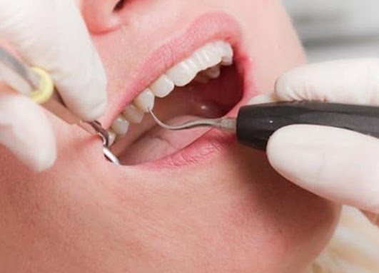 Treatment at medical centers itchy gums