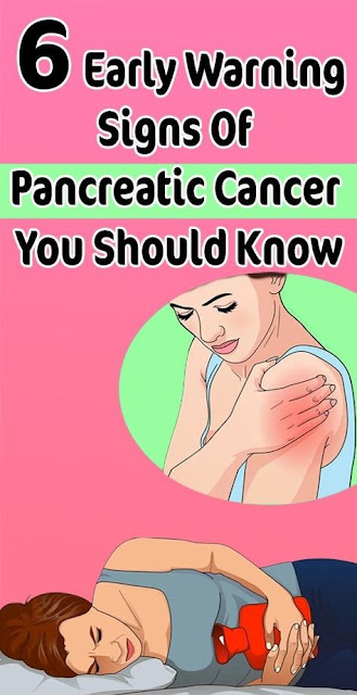6 Early Warning Signs Of Pancreatic Cancer You Should Know