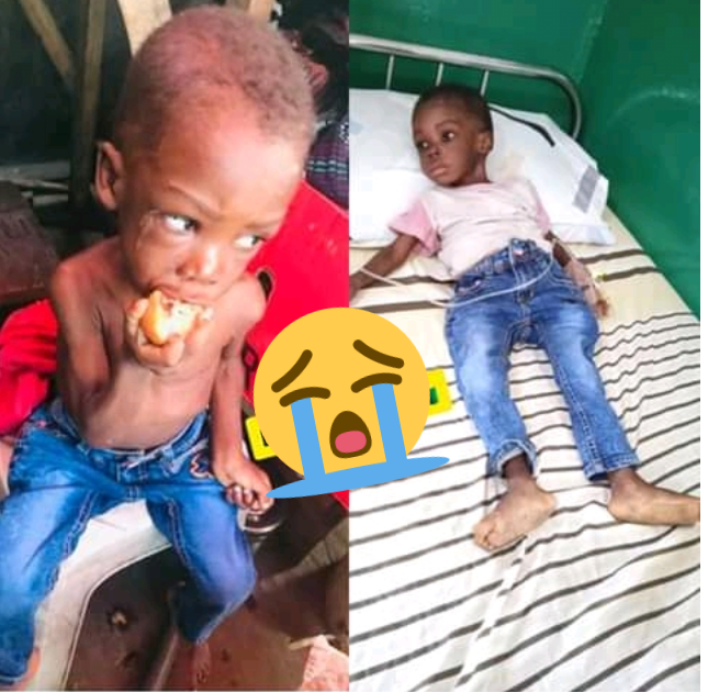 2YearOld Boy Starved By His Father And Stepmother In Warri Rescued