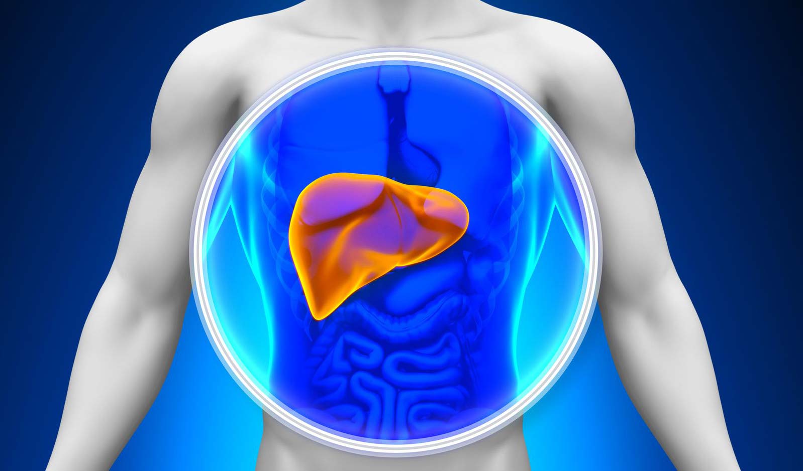 HEPATITIS ALCOHÓLICA