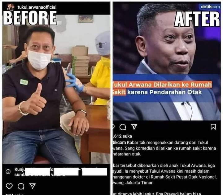 HEBOH... Belum Lama Divaksin, Tukul Arwana Alami Pendarahan Otak