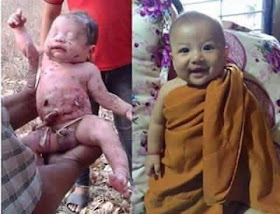 See current photos of the Baby Girl who was thrown in a dump and was saved by a Dog