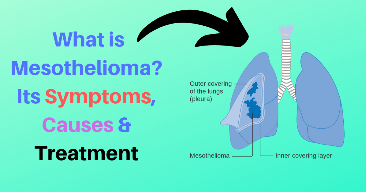 is keytruda fda approved for mesothelioma