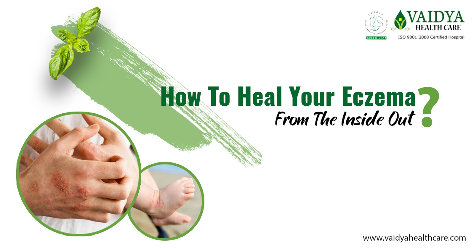 Ayurvedic Treatment Is The Best Option For Curing Dermatitis