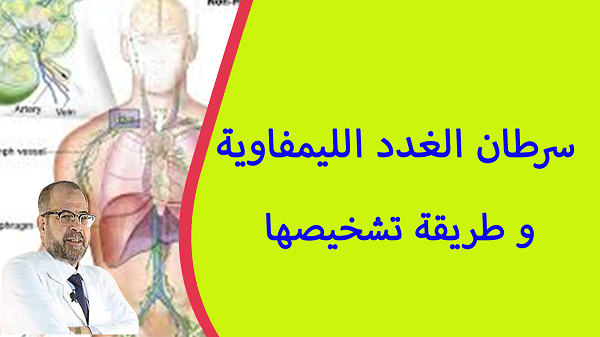سرطان الغدد الليمفاوية و طريقة تشخيصها محبى د جودة محمد عواد