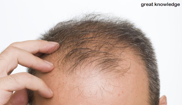 What Are The Causes Of Hair Loss What Are The Natural Ways To