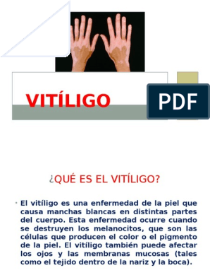 Vitiligo PDF