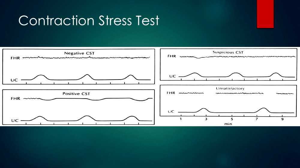Contraction stress test