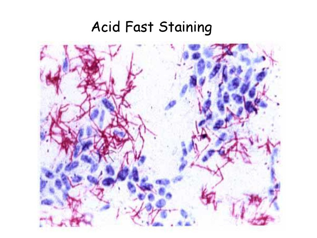 AcidFast Stain Protocols ZiehlNeelsen, Kinyoun, Truant Methods