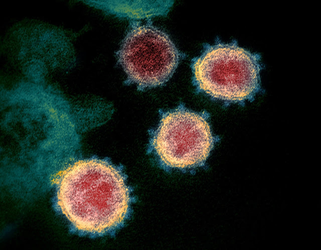 Şiddetli akut solunum yolu sendromu koronavirüsü 2 elektron mikroskobu görüntüsü