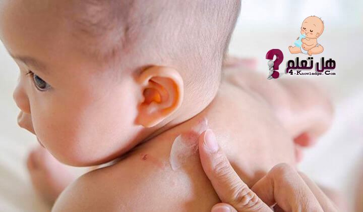 الطفح الجلدى عند الرضع