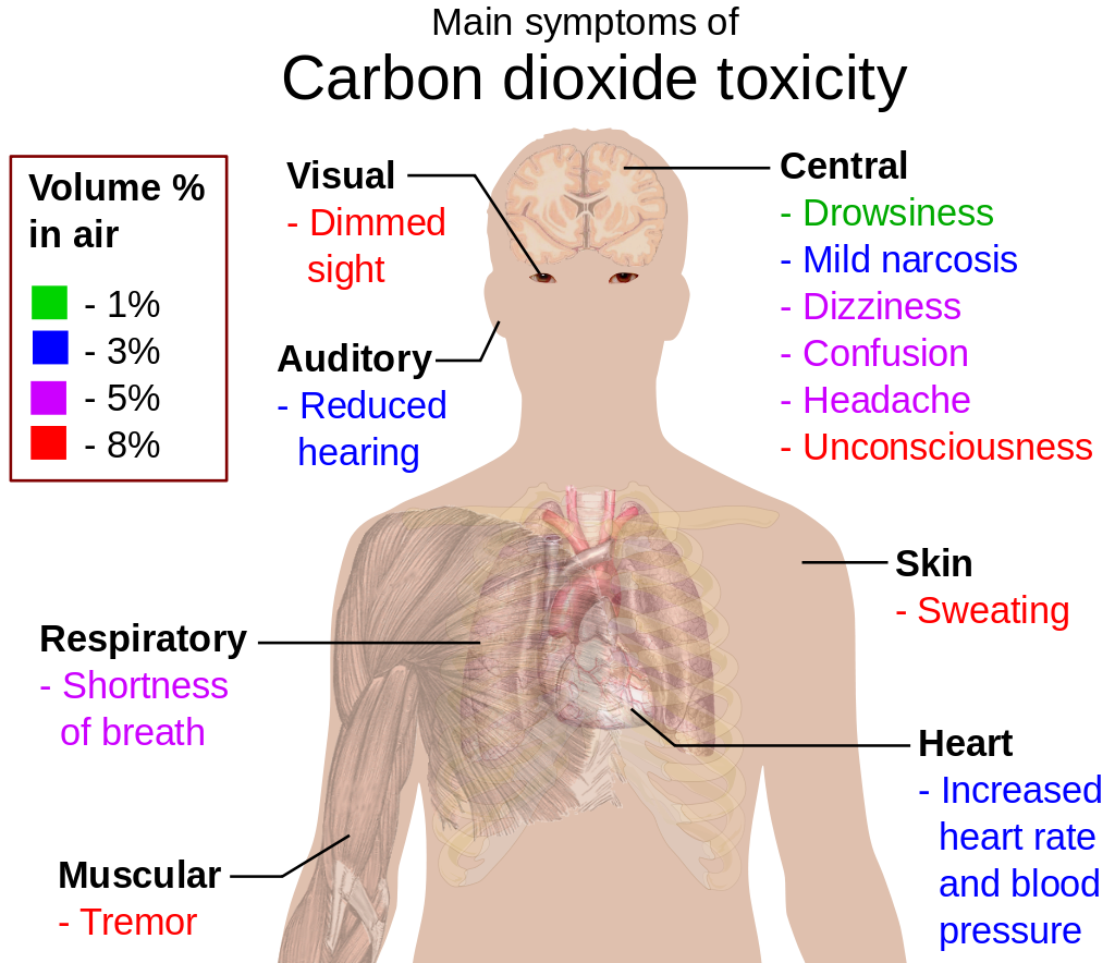 carbon dioxide poisoning on imaging carbon dioxide poisoning on imaging