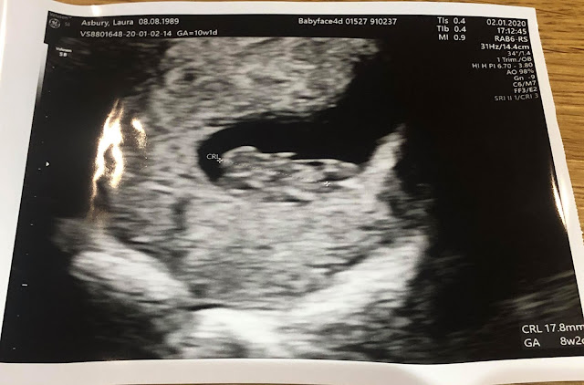 Early baby scan - 8 weeks pregnant