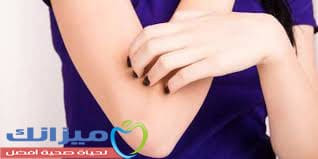 تجربتي لتبييض الركب والأكواع في ثلاثة أيام