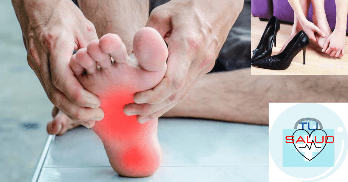 ¿QUÉ SINTOMAS NOS PUEDEN HACER SOSPECHAR QUE SUFRIMOS FASCITIS PLANTAR?