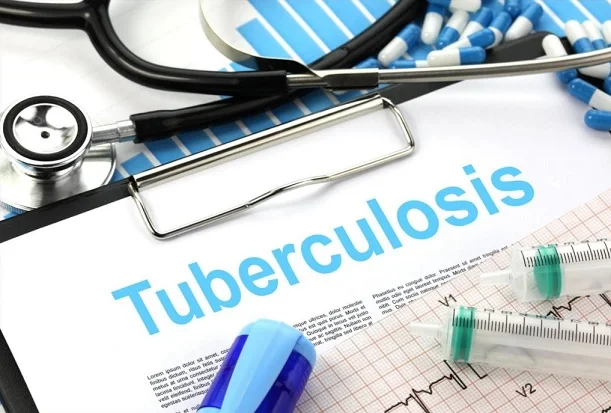 Hubungan Tingkat Pengetahuan Penderita TB Paru Dengan Tindakan Pencegahan Penularan di Ampenan