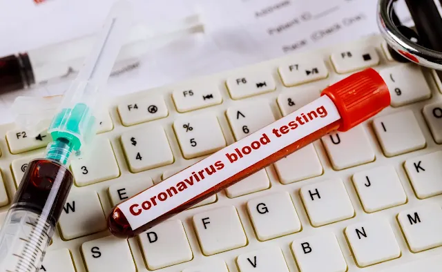 Şantiyelerde Koronavirüse Karşı Nasıl Önlem Alınır?