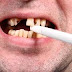 Thuốc lá làm hại răng như thế nào?