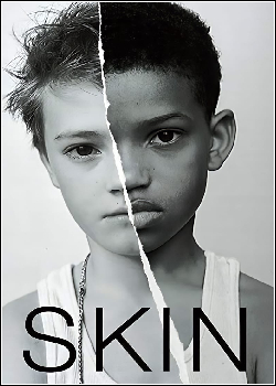 Skin Dublado