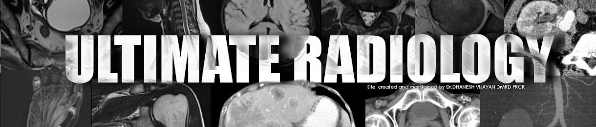 Ultimate Radiology 