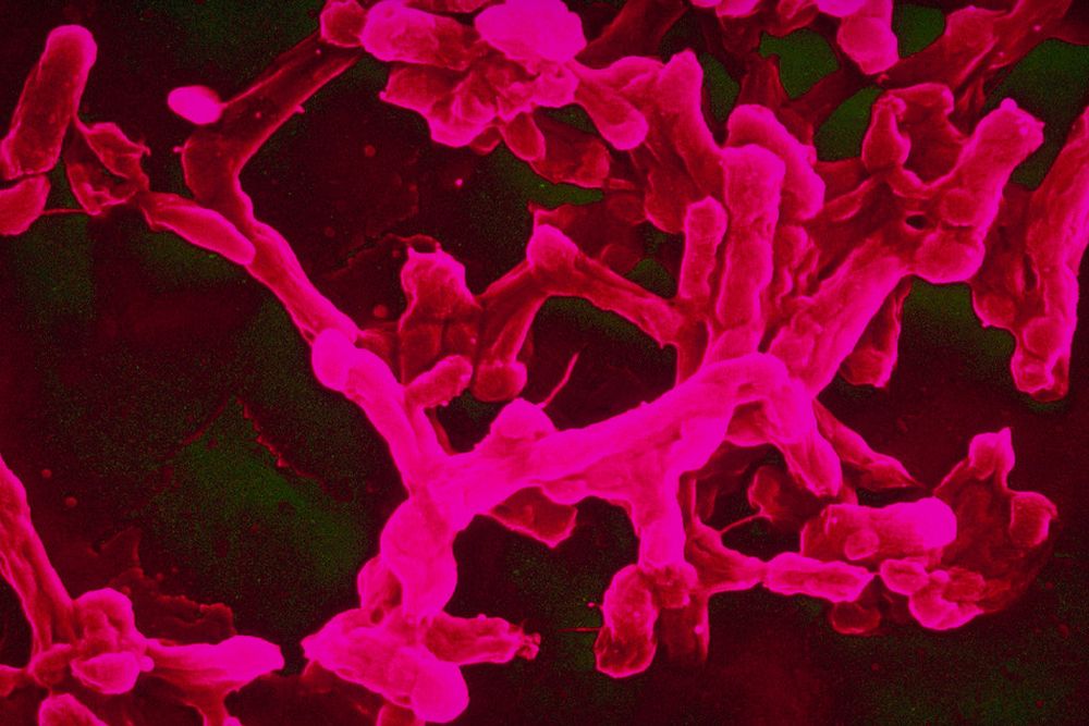 Typhoid bacteria (Salmonella typhi) under electron microscope.