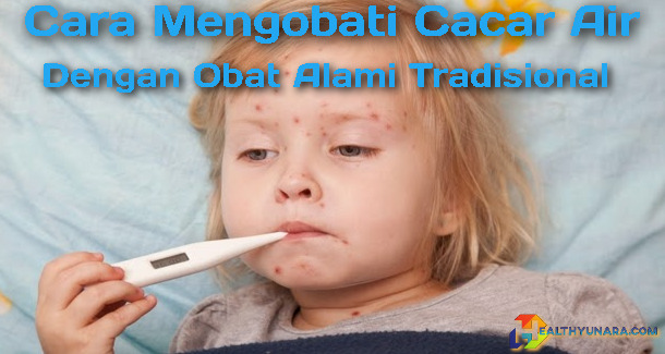 Cara Mengobati Cacar Air Dengan Obat Alami Tradisonal Cara Mengobati Cacar Air Dengan Obat Alami Tradisonal