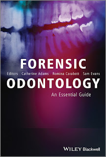 Forensic Odontology, An Essential Guide