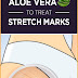 Aloe Vera For Stretch Marks Removal Naturally