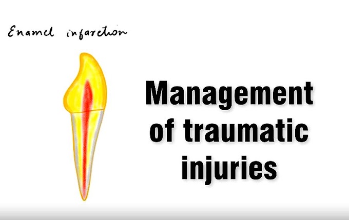 DENTAL TRAUMA: Management of Traumatic injuries of Teeth: PART I