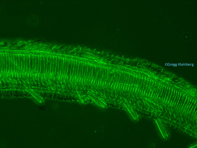 Microscopy image using green interference filter and phase contrast.