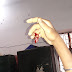  सिकंदरपुर बलिया : चेन में फंसने से मेकेनिक की कटी उंगली,बलिया रेफर