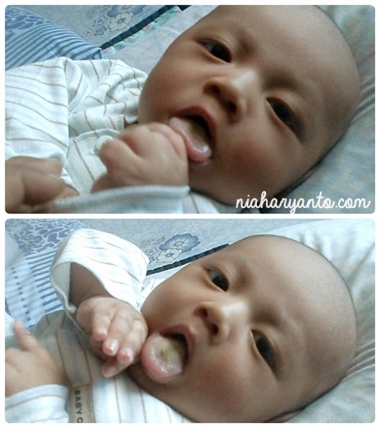 Nia Haryanto S Blog Waspadai Lidah Putih Pada Bayi