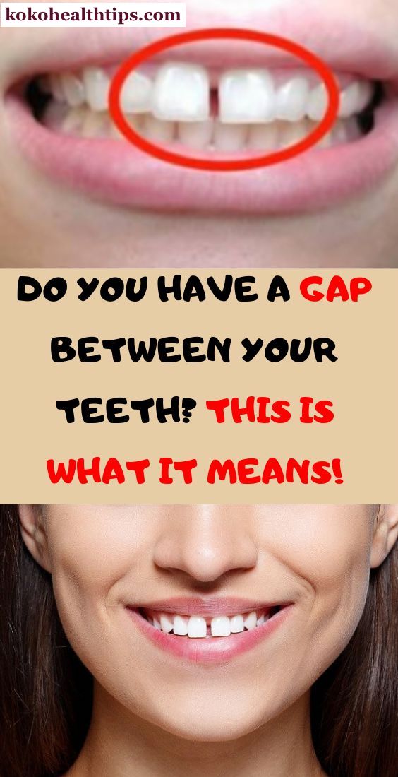 gap between teeth means advertising healthcare health dental activities tips flat
