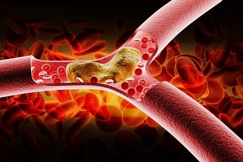 Health Benefits of Eggplant Water Health Benefits of Eggplant Water