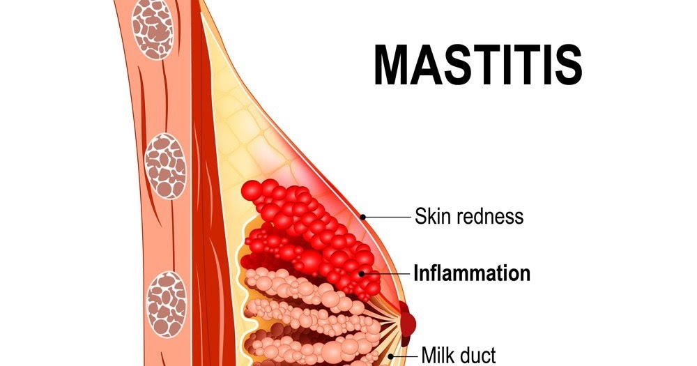 Mastitis Diary CheCha