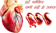 हार्ट ब्लॉकेज कभी नही हो सकता, Heart Blockage Can Never Happen in hindi, हार्ट में ब्लॉकेज होना मतलब गंभीरता पूर्वक इलाज की जरूरत, having a blockage in the heart means the need for serious treatment in indi, हार्ट के मुख्य कारण और क्यों, the main causes of heart failure and why in hindi, हार्ट ब्लॉकेज के संकेत, heart blockage signs in hindi, हार्ट ब्लॉकेज का घरेलू इलाज और परहेज, home treatment and prevention of heart blockage in hindi, हार्ट में ब्लॉकेज न होने दे, don't let there be blockage in the heart in hindi, हार्ट ब्लॉकेज के लिए अनार फायदेमंद, pomegranate is beneficial for heart blockage in hindi, हार्ट ब्लॉकेज के लिए अर्जुन वृक्ष की छाल फायदेमंद, bark of Arjun tree is beneficial for heart blockage in hindi, हार्ट ब्लॉकेज के लिए दालचीनी फायदेमंद, cinnamon beneficial for heart blockage in hindi, हार्ट ब्लॉकेज के लिए लाल मिर्च फायदेमंद, red chili is beneficial for heart blockage in hindi, हार्ट ब्लॉकेज के लिए फायदेमंद, beneficial for heart blockage in hindi, हार्ट ब्लॉकेज के लिए अलसी फायदेमंद, linseed beneficial for heart blockage in hindi, हार्ट ब्लॉकेज के लिए लहसुन फायदेमंद, garlic is beneficial for heart blockage in hindi, हार्ट ब्लॉकेज के लिए हल्दी फायदेमंद, turmeric is beneficial for heart blockage in hindi,  हार्ट ब्लॉकेज के लिए नींबू फायदेमंद, lemon is beneficial for heart blockage in hindi, खून गाढ़ा न होने दे, don't let the blood thicken in hindi, हार्ट ब्लॉकेज के लिए अंगूर फायदेमंद, grapes beneficial for heart blockage in hindi, हार्ट ब्लॉकेज के लिए अदरक फायदेमंद, ginger is beneficial for heart blockage in hindi, हार्ट ब्लॉकेज के लिए तुलसी फायदेमंद, tulsi is beneficial for heart blockage in hindi, हार्ट ब्लॉकेज के लिए लौकी फायदेमंद, gourd beneficial for heart blockage in hindi, हार्ट ब्लॉकेज के लिए इलायची फायदेमंद, cardamom beneficial for heart blockage in hindi, पीपल के पत्तों से हार्ट ब्लॉकेज की रोकथाम फायदेमंद, prevention of heart blockage is beneficial with peepal leaves in hindi, हार्ट ब्लॉकेज की रोकथाम, heart blockage prevention in hindi, heart blockage ke liye kya khana chahiye in hindi, heart blockage ke lakshan hindi mai, heart blockage symptoms in hindi, heart blockage ke karan in hindi, heart blockage ke liye upyogi in hindi, heart blockage treatment in homeopathy in hindi, heart blockage meaning in hindi,  heart blockage kyon hota hai in hindi,  heart blockage kya hai in hindi,  heart blockage ki prasani in hindi,  heart blockage ki photo,  heart blockage image,  heart blockage jpeg,  heart blockage jpg,  heart blockage pdf in hindi,  heart blockage artcile in hindi, main reasons for heart and why in hindi, heart blockage signs in hindi, home treatment and prevention of heart blockage in hindi, heart blockage ke liye yoga in hindi, pomegranate for heart blockage in hindi, arjun tree bark for heart blockage in hindi, cinnamon for heart blockage in hindi, red chillies for heart blockage in hindi, linseed for heart blockage in hindi, garlic for heart blockage in hindi, turmeric for heart blockage in hindi, lemon for heart blockage in hindi, grapes for heart blockage in hindi, ginger for heart blockage in hindi, tulsi for heart blockage in hindi, gourd for heart blockage in hindi, cardamom for heart blockage in hindi, prevention of heart blockage from peepal leaves in hindi, heart blockage prevention in hindi,  sakshambano, sakshambano ka uddeshya, latest viral post of sakshambano website, sakshambano pdf hindi,
