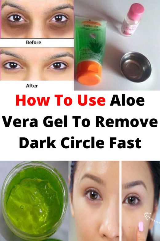 How To Use Aloe Vera Gel To Remove Dark Circle Fast Be One