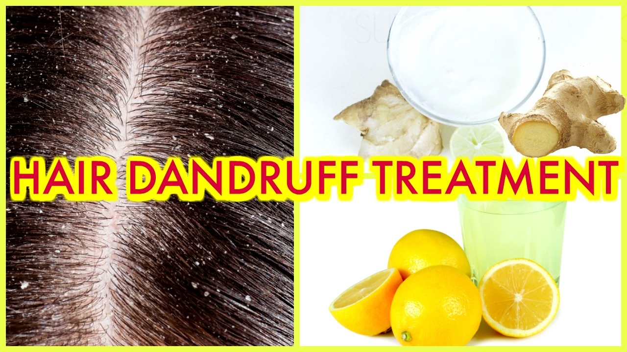 How To Get Rid Of Dandruff Using Natural Products?