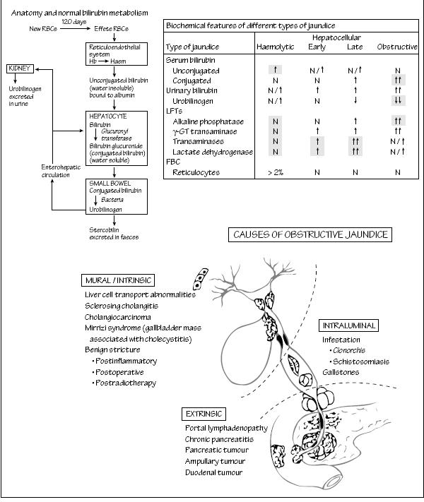 Causes Of Obstructive Jaundice / Approach to Obstructive Jaundice