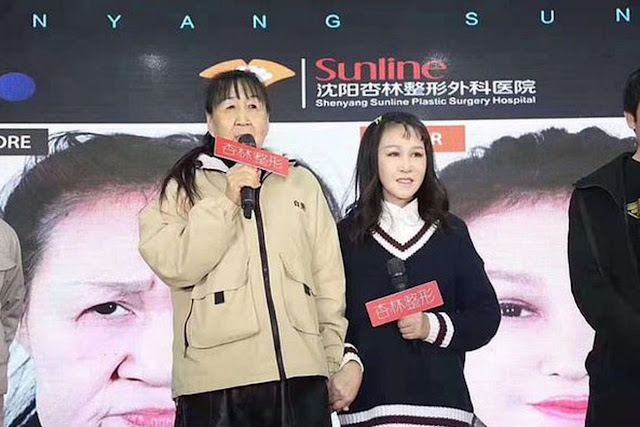  15-летняя китаянка бросила школу, стесняясь своего вида