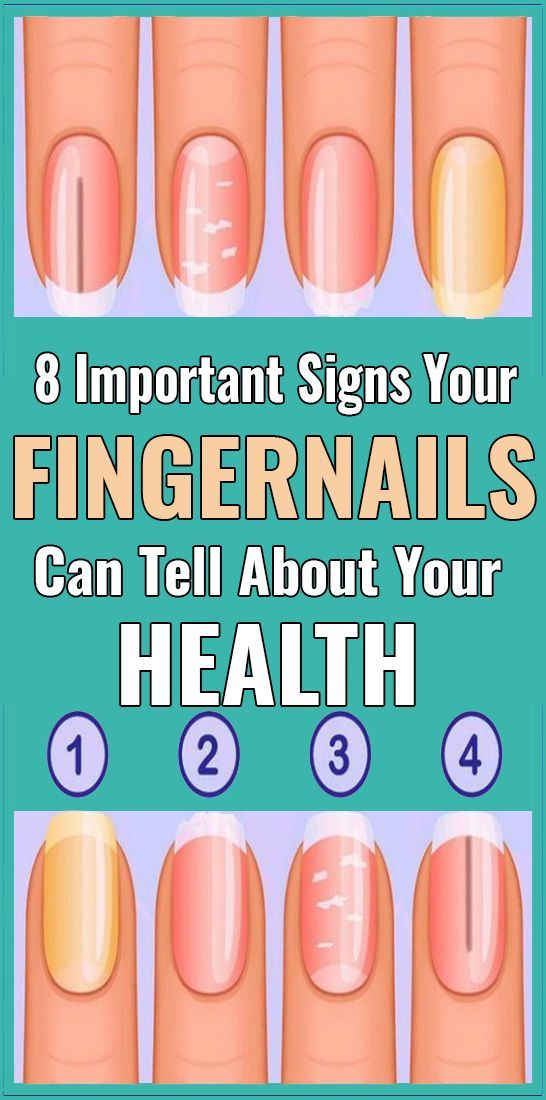 8 Important Signs Your Fingernails Can Tell About Your Health Healthy