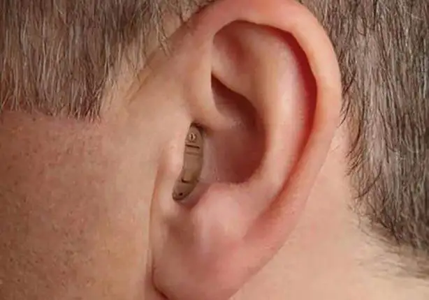 اسعار السماعات الطبية لعلاج ضعف السمع