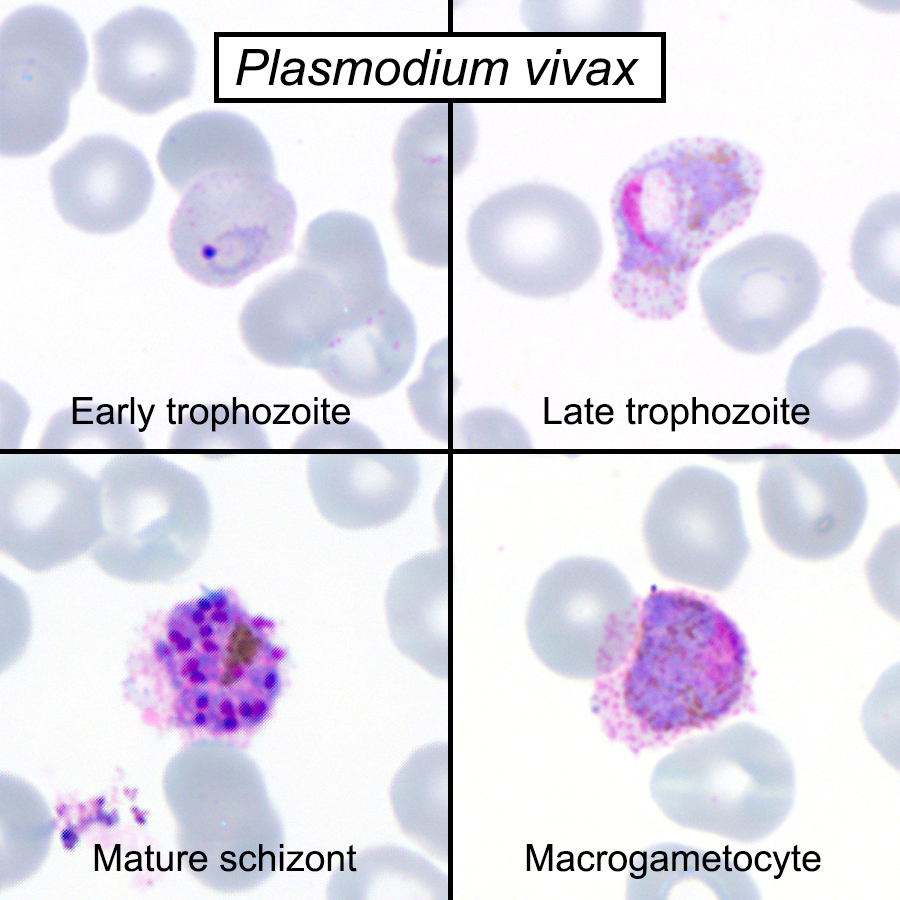 Continuous in vitro propagation of the malaria parasite Plasmodium vivax |  PNAS