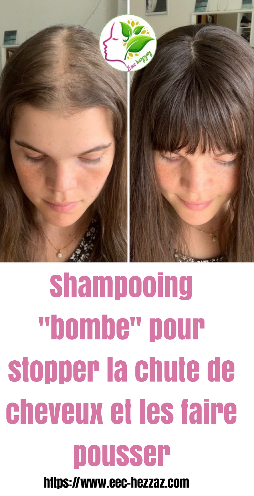 Shampooing "bombe" pour stopper la chute de cheveux et les faire pousser