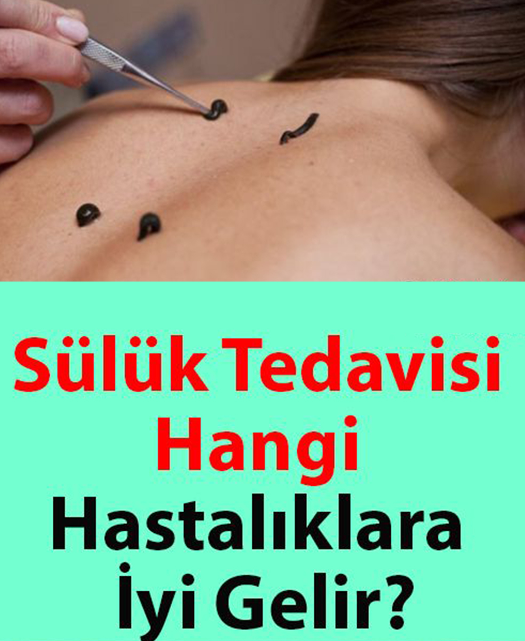 tedavisi hangi hastaliklara iyi gelir