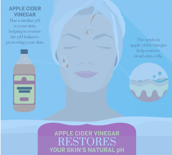 The Magical Potion APPLE CIDER VINEGAR FOR CYSTIC ACNE