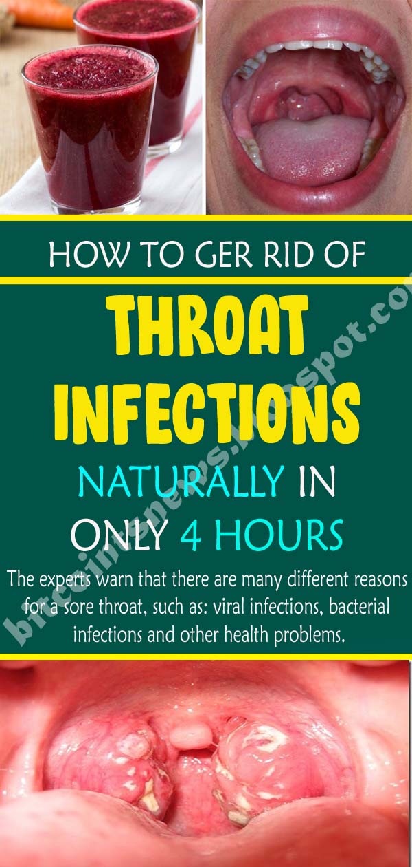 How to Get Rid of Throat Infections Naturally in Only 4 Hours