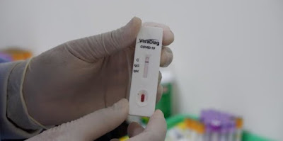 Cara Akses Situs Covid 19 Tanpa Paket Internet Cara Akses Situs Covid 19 Tanpa Paket Internet